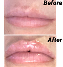 Load image into Gallery viewer, Gerard Kiss Assist Lip Plumper
