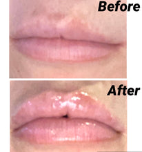 Load image into Gallery viewer, Gerard Kiss Assist Lip Plumper